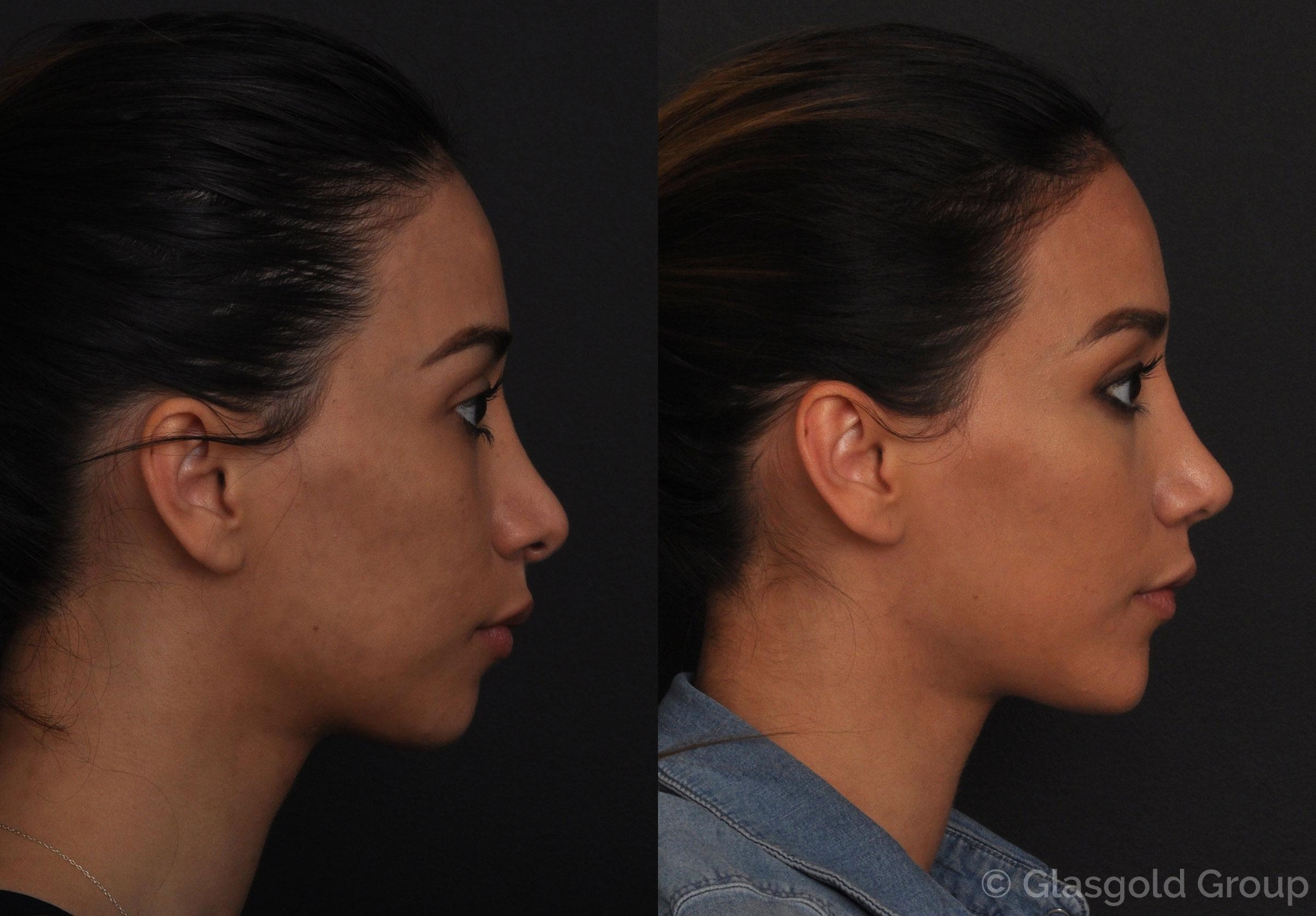 cosmetic surgery manchester
